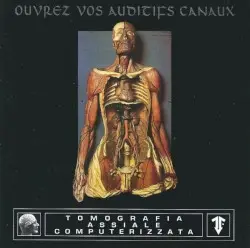 Ouvrez vos auditifs canaux by Tomografia Assiale Computerizzata
