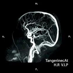 H.R V.I.P by tAngerinecAt