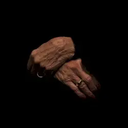 Reflecting on a Dying Man by Diamondstein