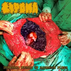 Infernal Wounds of Ravenous Flesh by Lipoma