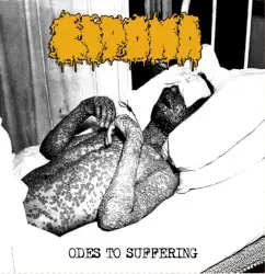 Odes to Suffering by Lipoma