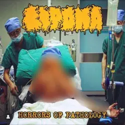 Horrors of Pathology by Lipoma