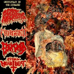 Onchyophagy in the Diseased by Septic Necrosis / Fragged / Flax / Final Heartbeat